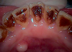 クリーニング前