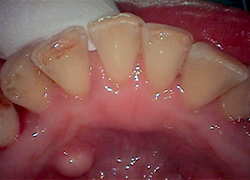 クリーニング後